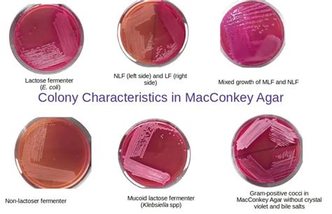 macconkey agar ingredients